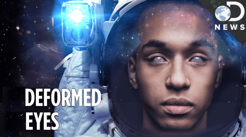 Space deforms & damages&nbsp;eyes